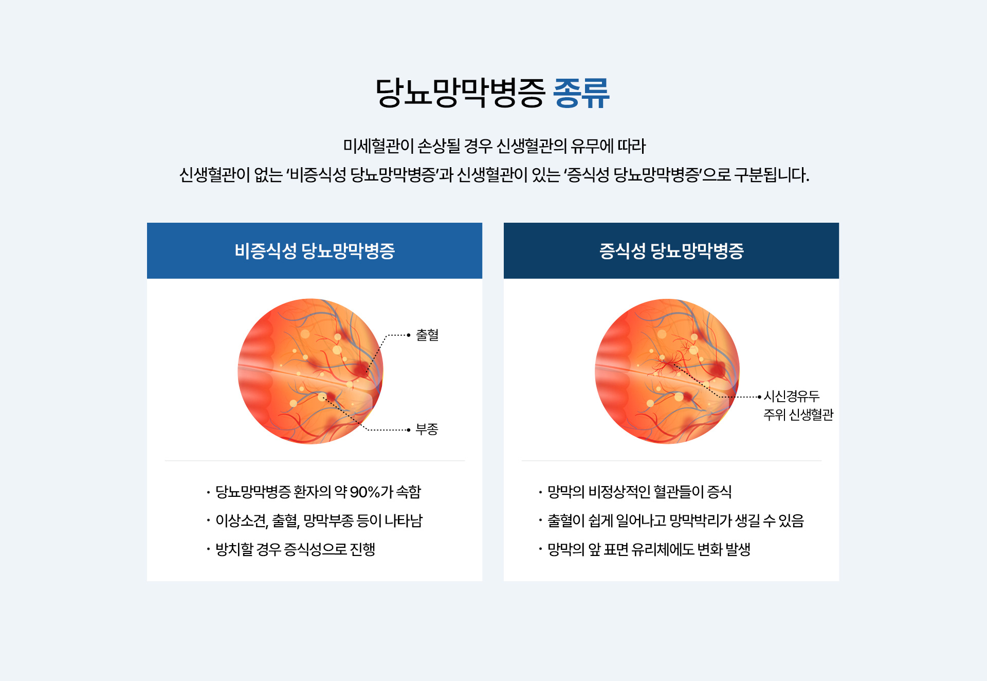 당뇨망막병증_02