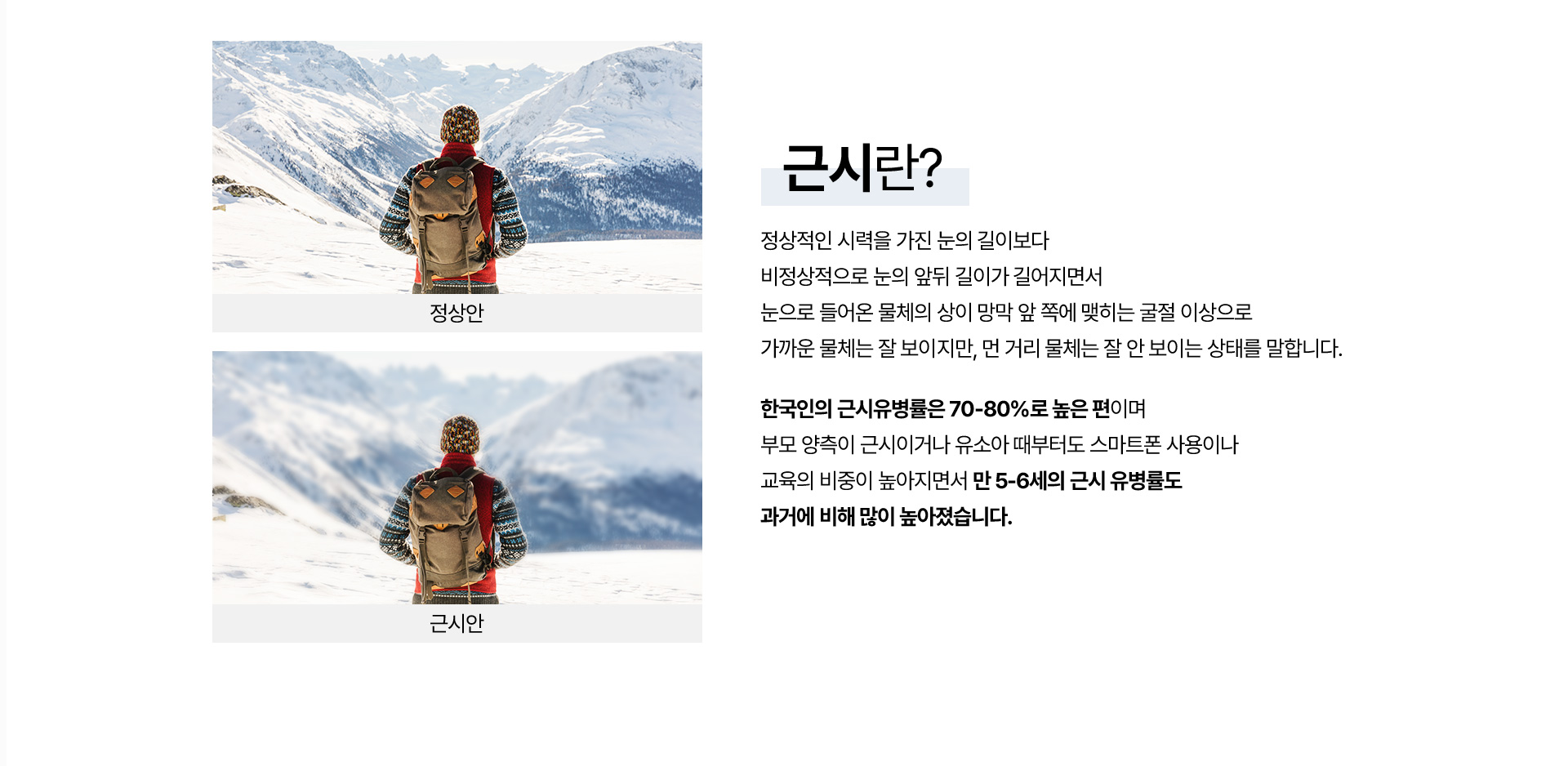 근시억제약물치료_02