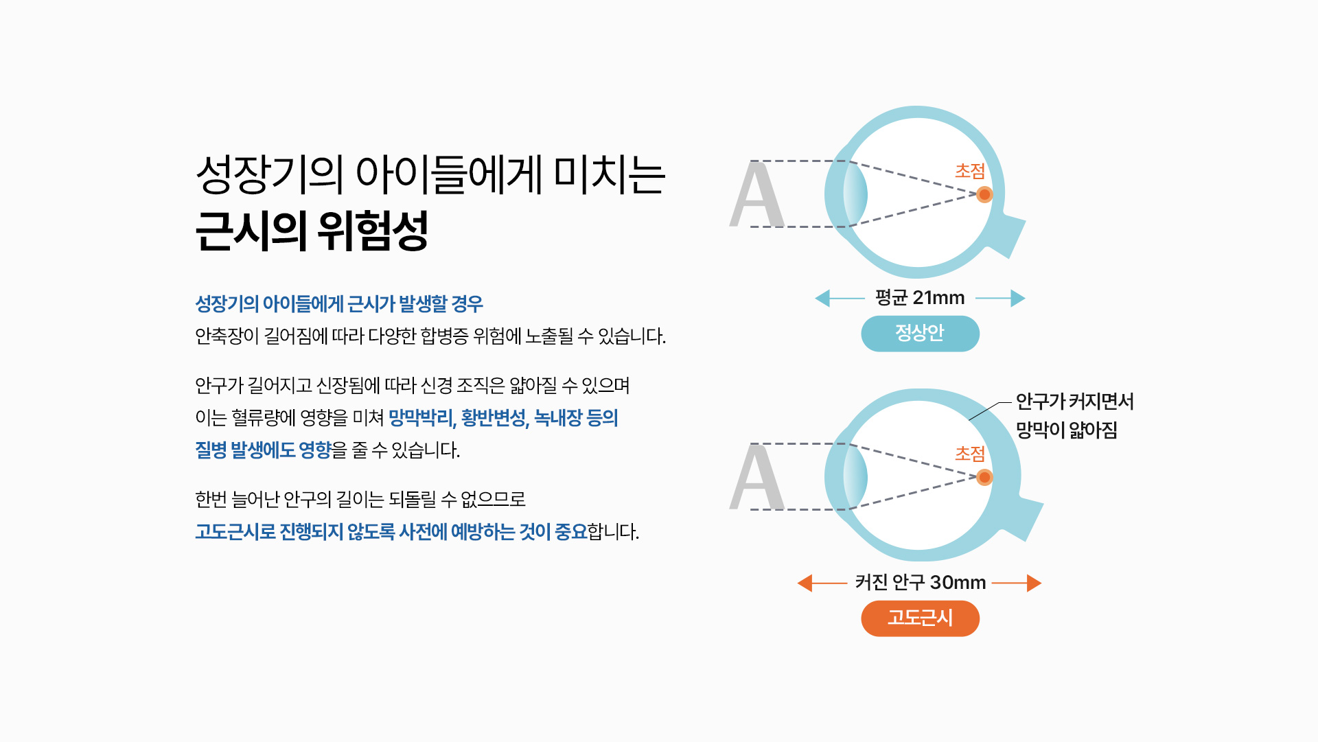 근시억제약물치료_04