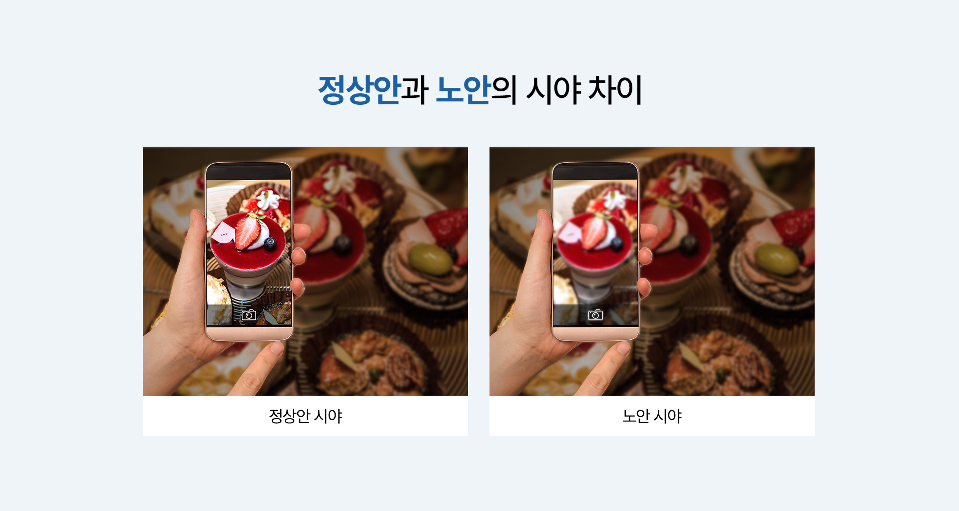 노안_03