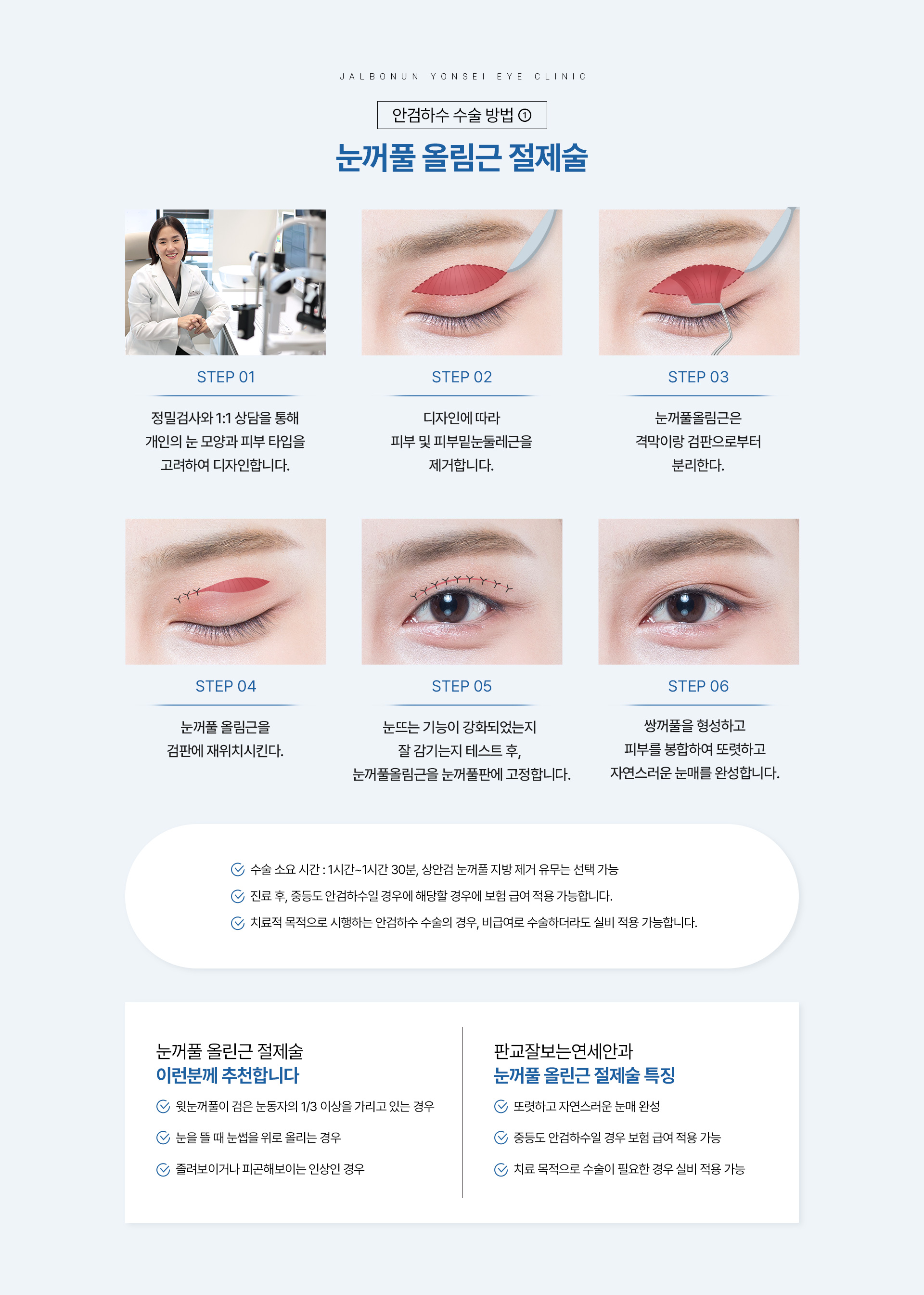 안검하수_09