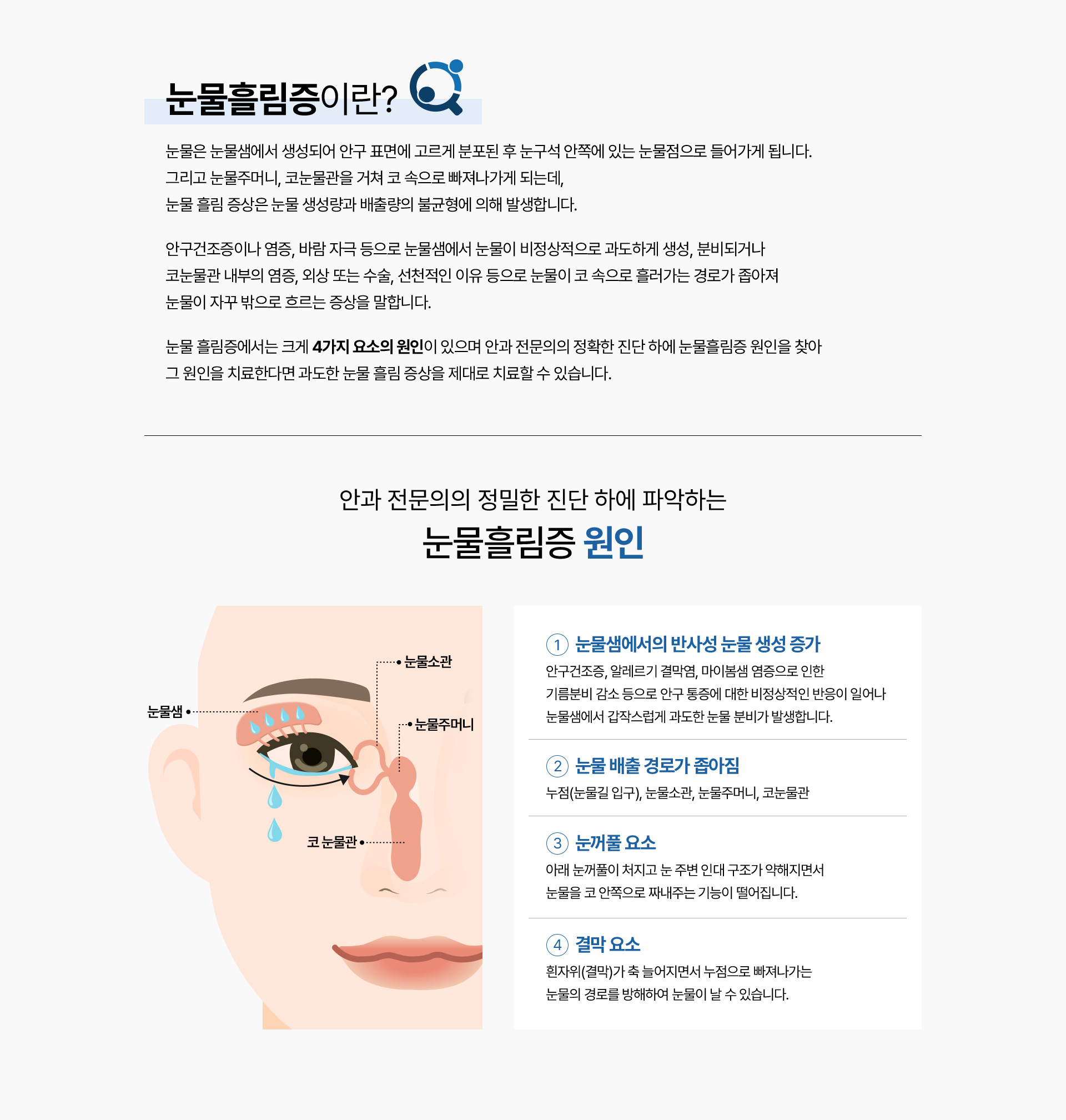 눈물흘림증 치료_05