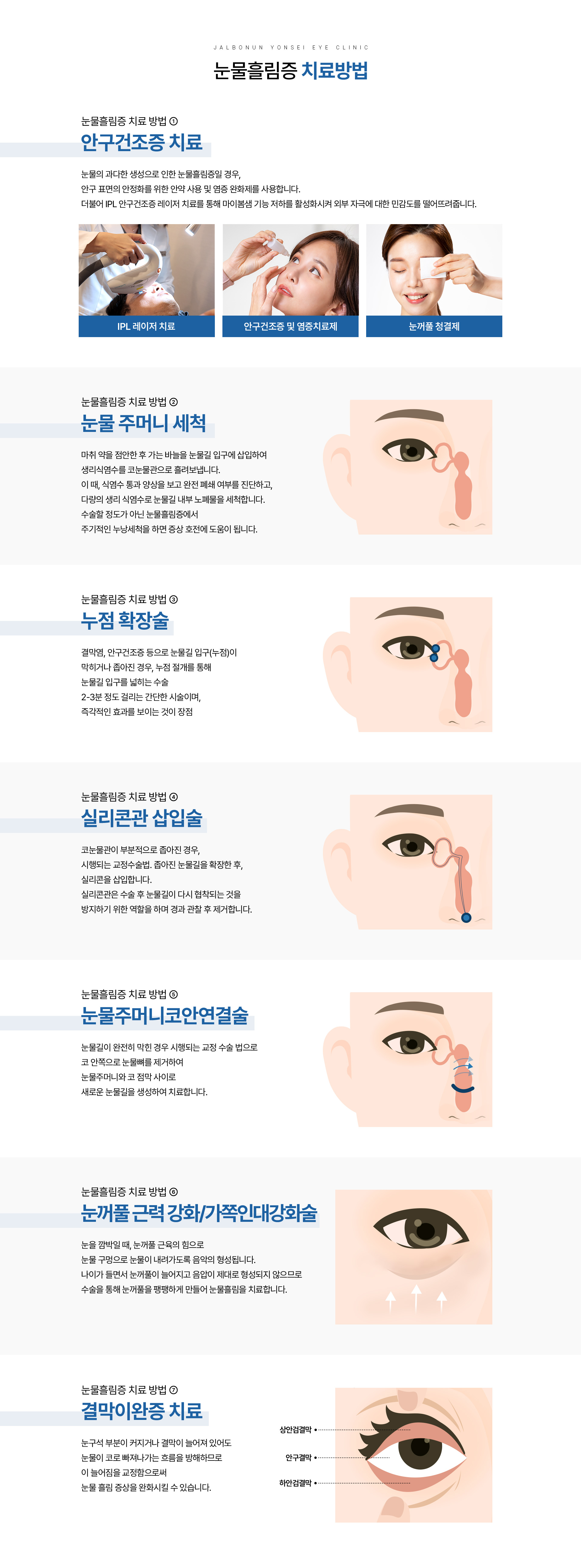 눈물흘림증 치료_07