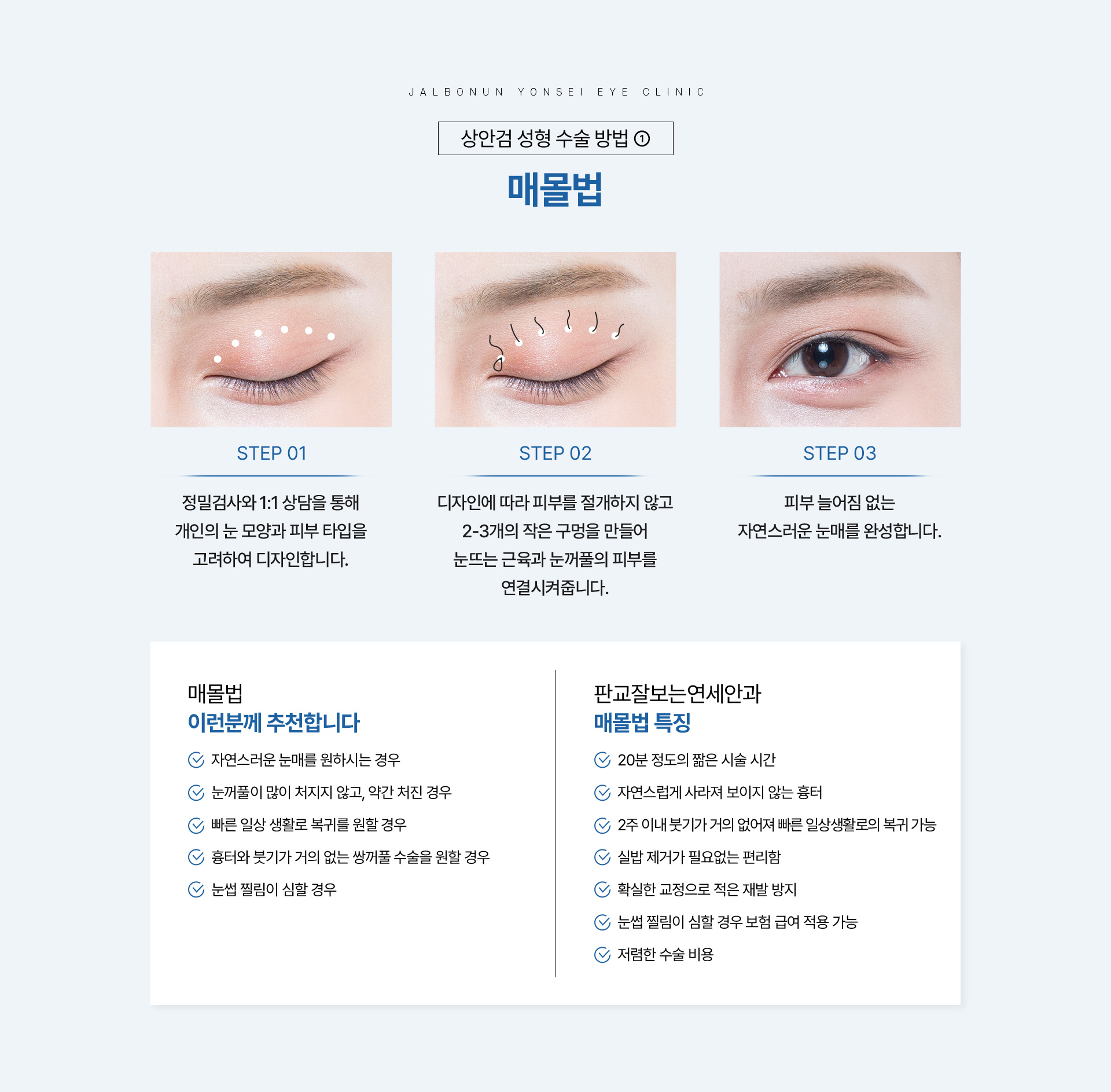 상안검 성형_07