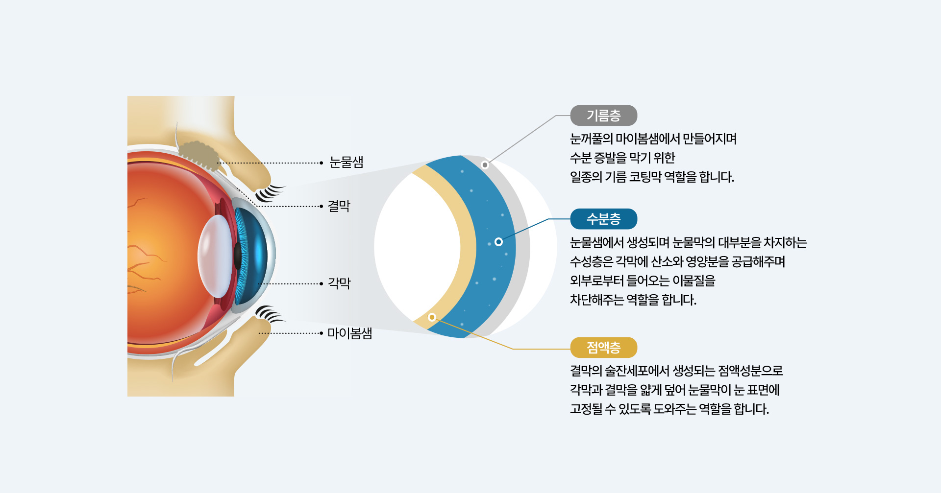 안구건조증_02